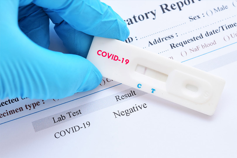 Photo of Covid-19 Test kit